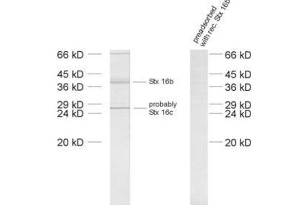 Syntaxin 16 antibody  (AA 1-302)