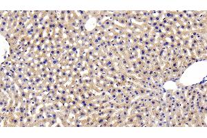 Detection of INSR in Mouse Liver Tissue using Polyclonal Antibody to Insulin Receptor (INSR) (Insulin Receptor antibody  (AA 1101-1372))