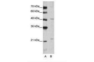 Image no. 1 for anti-WD Repeat Domain 12 (WDR12) (C-Term) antibody (ABIN202489) (WDR12 antibody  (C-Term))