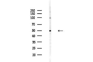 Western blot analysis of lysates from HepG2 cells(LPS,4h treatment), using KCNF1 Antibody at 1/1000 dilution.