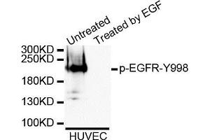Western blot analysis of extracts of A431 cell, using Phospho-EGFR-Y998 antibody. (EGFR antibody  (pTyr998))