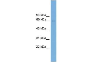 WB Suggested Anti-CARD9 Antibody Titration: 0. (CARD9 antibody  (Middle Region))
