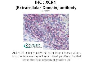 Image no. 1 for anti-Chemokine (C Motif) Receptor 1 (XCR1) (3rd Extracellular Domain) antibody (ABIN1740868) (XCR1 antibody  (3rd Extracellular Domain))