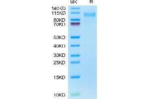 CD31 Protein (AA 28-602) (His tag)