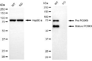 Western blotting analysis using PCSK9 antibody (ABIN7799928).
