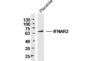 Western Blotting (WB) image for anti-Interferon alpha/beta Receptor 2 (IFNAR2) (AA 165-260) antibody (ABIN721825)