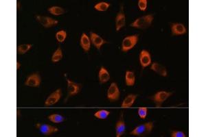 PPP1R9B antibody