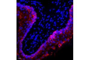 Immunofluorescence of paraffin embedded rat esophagus using CK13 (ABIN7074412) at dilution of 1:1500 (400x lens) (Cytokeratin 13 antibody  (N-Term))