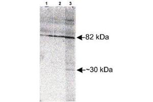 Western blot analysis of Scarb2 in Jurkat whole cell lysate with Scarb2 polyclonal antibody  at different concentration : Lane 1, 1 : 1000.