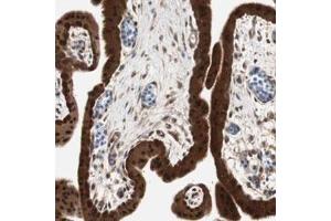 Immunohistochemical staining (Formalin-fixed paraffin-embedded sections) of human placenta with GALT polyclonal antibody  shows strong nuclear and cytoplasmic positivity in trophoblastic cells. (GALT antibody)