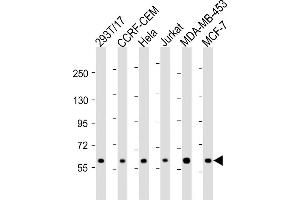 All lanes : Anti-RNF31 Antibody (C-term) at 1:2000 dilution Lane 1: 293T/17 whole cell lysate Lane 2: CCRF-CEM whole cell lysate Lane 3: Hela whole cell lysate Lane 4: Jurkat whole cell lysate Lane 5: MDA-MB-453 whole cell lysate Lane 6: MCF-7 whole cell lysate Lysates/proteins at 20 μg per lane. (RNF31 antibody  (C-Term))