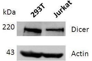 Western blot analysis of DICER expression in lysates of 293T and Jurkat cells. (DICER1 antibody  (full length))