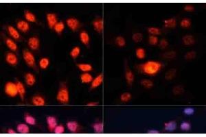 Immunofluorescence (IF) image for anti-Ribosomal Protein S6 Kinase, 70kDa, Polypeptide 1 (RPS6KB1) (pThr389) antibody (ABIN7265266)