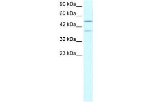 WB Suggested Anti-USP3 Antibody Titration:  0. (USP3 antibody  (N-Term))