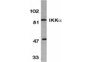 Western blot analysis of IKK alpha in HeLa whole cell lysate with AP30404PU-N IKK alpha antibody at 1/500 dilution. (IKK alpha antibody  (C-Term))