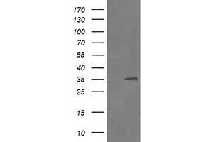 Image no. 2 for anti-Replication Factor C (Activator 1) 2, 40kDa (RFC2) (AA 1-234) antibody (ABIN1490617) (RFC2 antibody  (AA 1-234))