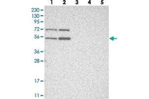 ZFP69 antibody