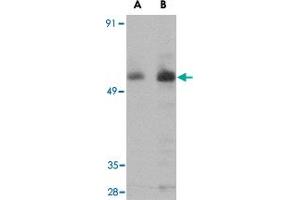 Western blot analysis of PARL in NIH/3T3 cell lysate with PARL polyclonal antibody  at (A) 1 and (B) 2 ug/mL . (PARL antibody  (N-Term))