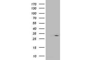 Western Blotting (WB) image for anti-Interferon-Induced Protein 35 (IFI35) antibody (ABIN1498801) (IFI35 antibody)