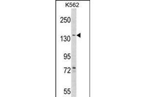 Western blot analysis of hAGL- (ABIN1882062 and ABIN2839246) in K562 cell line lysates (35 μg/lane). (AGL antibody  (AA 357-387))