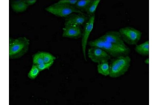 TLK2 antibody  (AA 23-234)