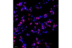 Immunofluorescence of paraffin embedded human lung using TFIIIC110 (ABIN7074038) at dilution of 1:650 (400x lens) (GTF3C2 antibody)