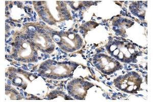 IHC analysis of Clathrin heavy chain/CLTC using anti-Clathrin heavy chain/CLTC antibody (ABIN7602704). (Clathrin Heavy Chain (CLTC) (AA 967-1668) antibody)
