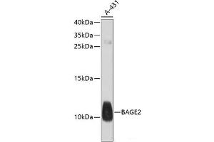 Western blot analysis of extracts of A-431 cells using BAGE2 Polyclonal Antibody at dilution of 1:1000. (BAGE2 antibody)