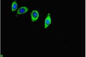 Immunofluorescent analysis of HepG2 cells using ABIN7144126 at dilution of 1:100 and Alexa Fluor 488-congugated AffiniPure Goat Anti-Rabbit IgG(H+L) (ACE2 antibody  (AA 395-638))