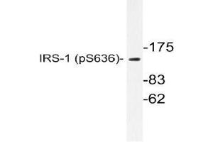 Western blot (WB) analyzes of p-IRS-1 antibody in extracts from COLO205 cells. (IRS1 antibody  (pSer636))