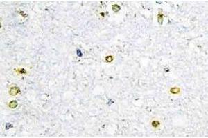 Immunohistochemistry (IHC) analyzes of TIF1alpha antibody in paraffin-embedded human brain tissue. (TRIM24 antibody)