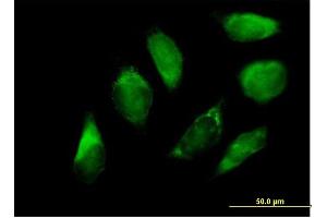 Immunofluorescence of purified MaxPab antibody to SERPINH1 on HeLa cell.