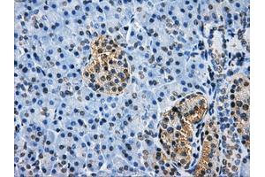 Immunohistochemical staining of paraffin-embedded Kidney tissue using anti-HDAC10mouse monoclonal antibody. (HDAC10 antibody)