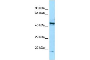 WB Suggested Anti-EIF2B2 Antibody Titration: 1. (EIF2B2 antibody  (Middle Region))