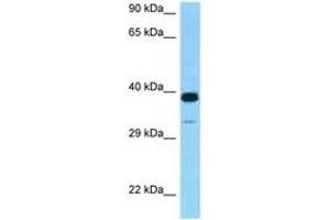Image no. 1 for anti-Cysteine-Rich with EGF-Like Domains 2 (CRELD2) (AA 135-184) antibody (ABIN6748231)