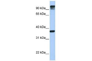 EPS15 antibody used at 1 ug/ml to detect target protein. (EPS15 antibody  (C-Term))
