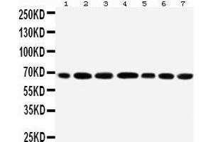 Anti-DDX5 antibody, Western blotting All lanes: Anti DDX5  at 0. (DDX5 antibody  (C-Term))