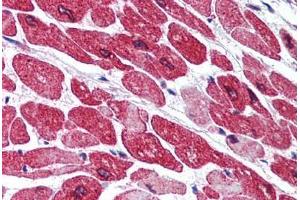 Human Heart (formalin-fixed, paraffin-embedded) stained with AOF2 antibody ABIN290327 at 5 ug/ml followed by biotinylated goat anti-rabbit IgG secondary antibody ABIN481713, alkaline phosphatase-streptavidin and chromogen. (LSD1 antibody  (AA 100-150))