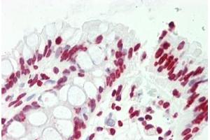 Human Colon: Formalin-Fixed, Paraffin-Embedded (FFPE) (Cyclin L2 antibody  (AA 338-366))