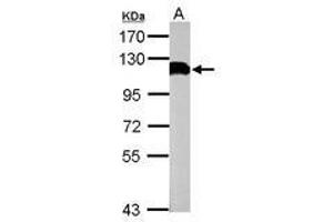 Image no. 1 for anti-Ubiquitin Specific Peptidase 13 (Isopeptidase T-3) (USP13) (C-Term) antibody (ABIN1491928) (USP13 antibody  (C-Term))