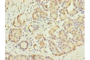 Immunohistochemistry (IHC) image for anti-Gastric Inhibitory Polypeptide Receptor (GIPR) (AA 22-138) antibody (ABIN7153669)