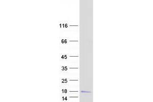 Validation with Western Blot (MRPS33 Protein (Transcript Variant 2) (Myc-DYKDDDDK Tag))