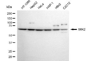 Western blotting analysis using S6K2 antibody (ABIN7800228).