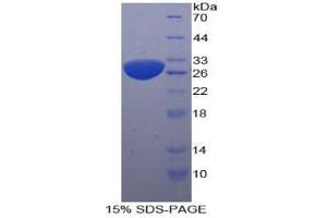 SDS-PAGE analysis of Human Sequestosome 1 Protein. (SQSTM1 Protein)