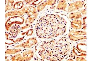 IHC image of ABIN7161797 diluted at 1:400 and staining in paraffin-embedded human kidney tissue performed on a Leica BondTM system. (NFATC3 antibody  (AA 887-1070))