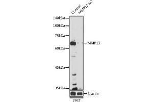 Western blot analysis of extracts from normal (control) and MMP13 knockout (KO) 293T cells, using MMP13 antibody (ABIN7268418) at 1:1000 dilution. (MMP13 antibody  (AA 262-471))