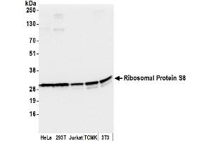 anti-Ribosomal Protein S8 (RPS8) (AA 158-208) antibody