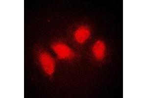 Immunofluorescent analysis of SMG7 staining in A431 cells. (SMG7 antibody  (Center))