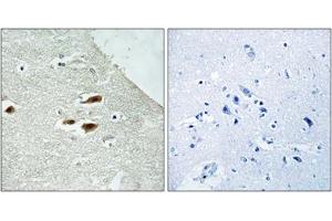Immunohistochemical staining of paraffin-embedded human brain tissue reacted with PER2 (phospho S662) polyclonal antibody  at 1:50-1:100 dilution. (PER2 antibody  (pSer662))