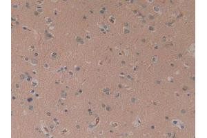 IHC-P analysis of Human Brain Tissue, with DAB staining. (CYLD antibody  (AA 170-338))
